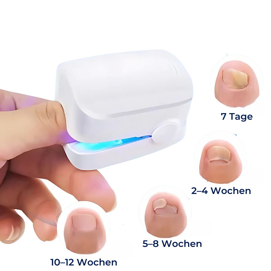 Nagelpilz-Lasergerät ClearNagel Pro – Schmerzfreie und effektive Behandlung für gesunde Nägel mit fortschrittlicher Laser-Technologie 3
