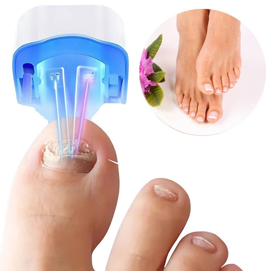 Nagelpilz-Lasergerät ClearNagel Pro – Schmerzfreie und effektive Behandlung für gesunde Nägel mit fortschrittlicher Laser-Technologie 1
